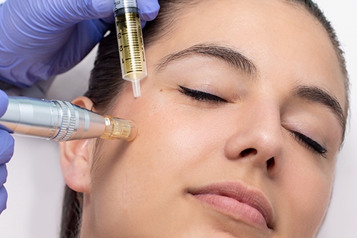 micro-needling best mature facials for your skin