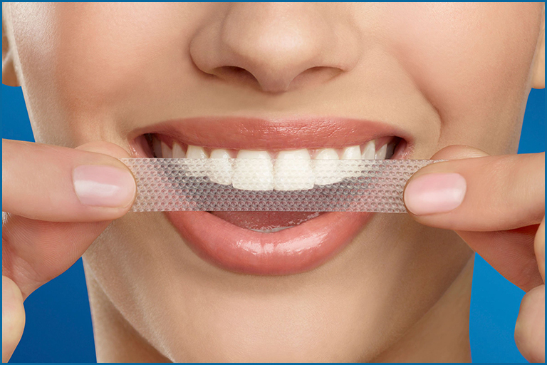 teeth whitening strips expire